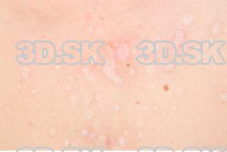 Skin texture of Pat 0001